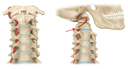 Позвоночная артерия Позвоночная артерия