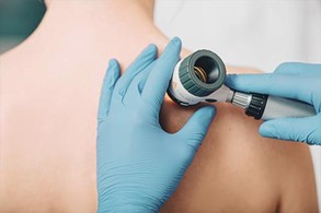 Дерматоскопия Дерматоскопия