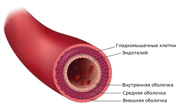 uzelkovyj-periarteriit 1 Узелковый периартериит