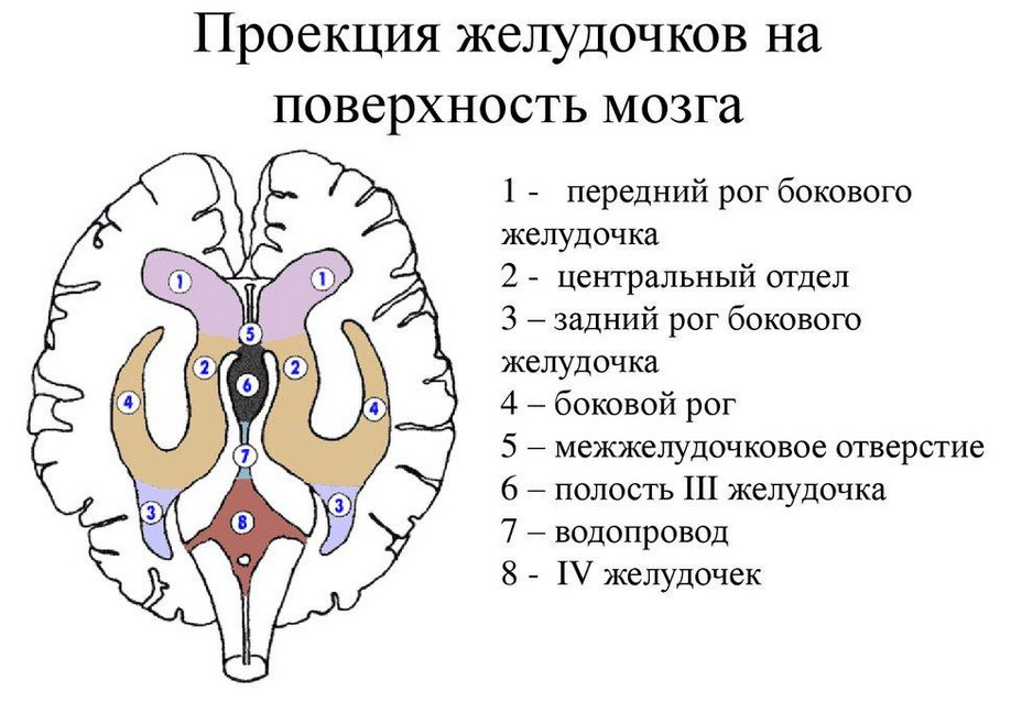 ventrikulomegaliya 1 Вентрикуломегалия