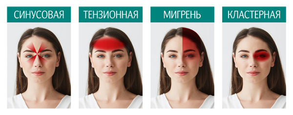 Основные типы головной боли Основные типы головной боли