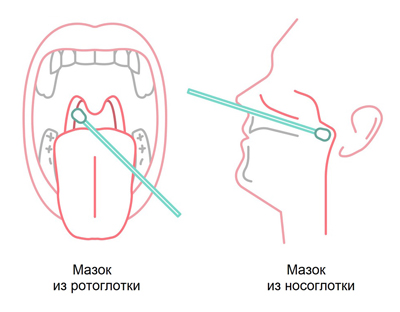 Виды взятия мазков Виды взятия мазков