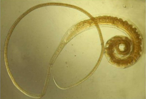 Власоглав Trichocephalus trichiurus 2