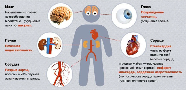 Влияние гипертонической болезни на различные органы Влияние гипертонической болезни на различные органы