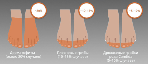 Возбудители грибковых заболеваний ногтей Возбудители грибковых заболеваний ногтей