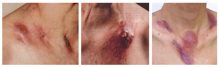 zolotuha foto Золотуха