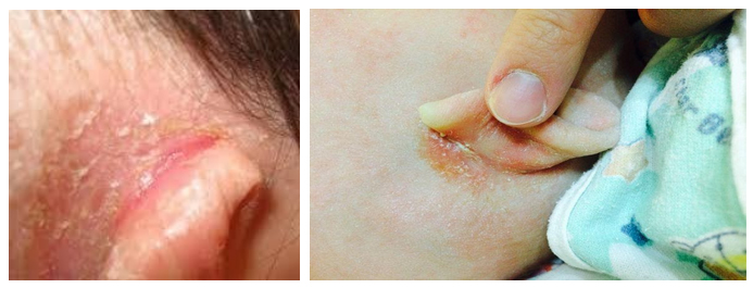 zolotuha primery Золотуха