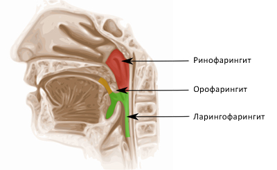 Зоны поражения при различных заболеваниях Зоны поражения при различных заболеваниях