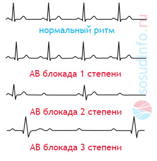 46484648648