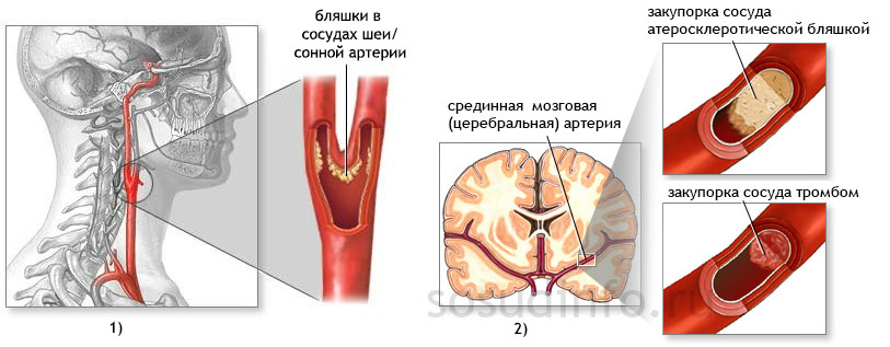 4684884486