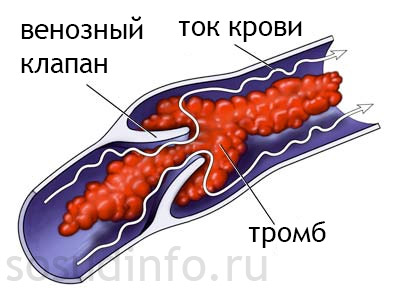 48948998+
