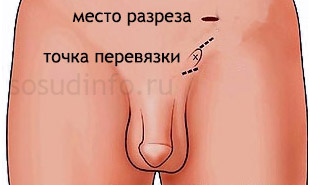 54644884486