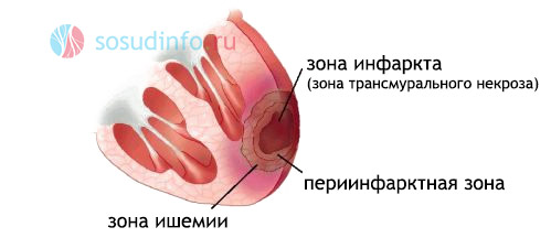 5465468468