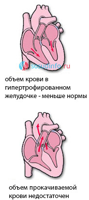 5468446