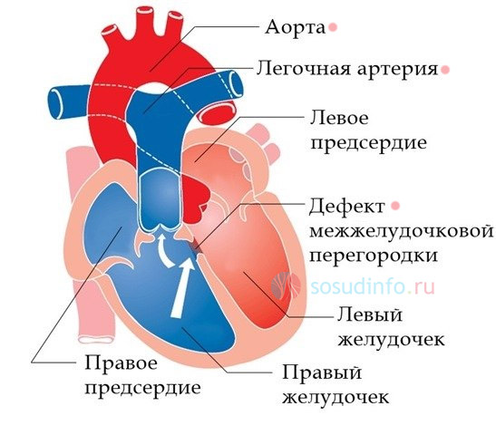 54684864