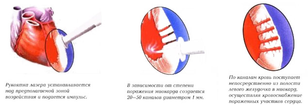 5468844468