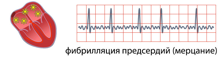 5468864684