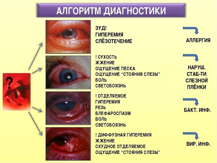 Алгоритм диагностики глаза