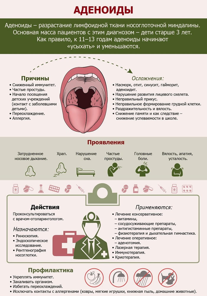 Гиперплазия аденоидов человека