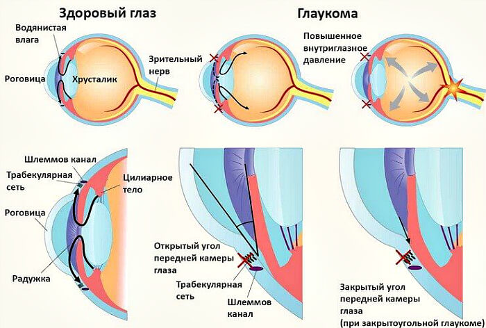 Изменения при болезни