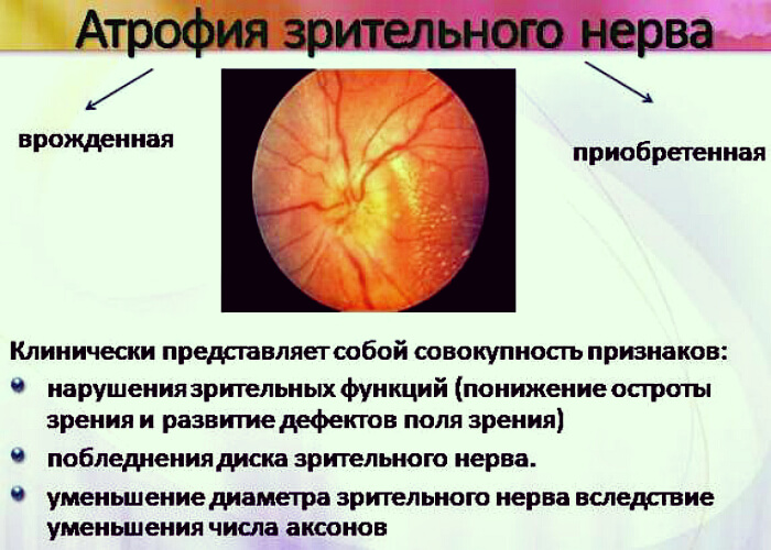 Клиническая картина атрофии