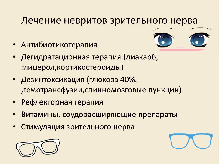 Лечение зрительного неврита