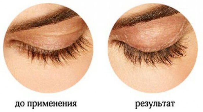До и после