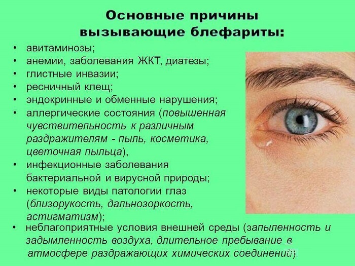 Основные причины блефарита