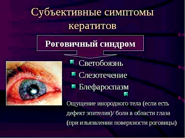 Основные признаки кератита