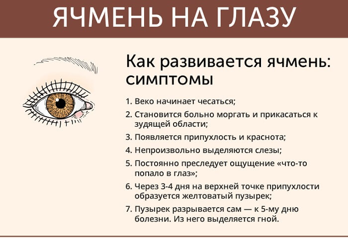 Основные симптомы ячменя