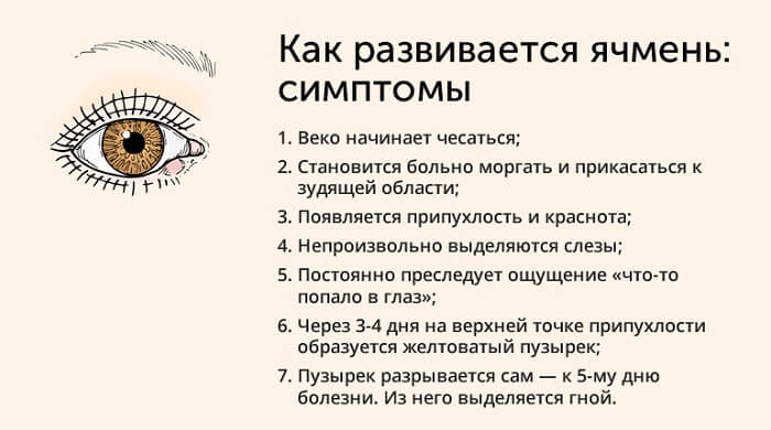 Основные симптомы ячменя