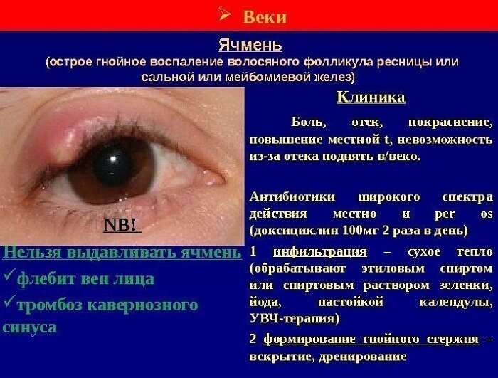 Острое гнойное воспаление