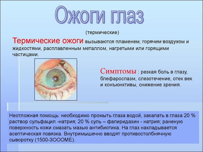 Ожоги роговицы у человека
