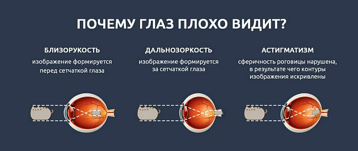 Причины проблем со зрением
