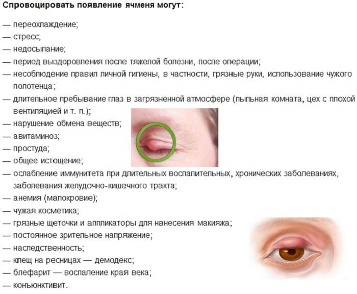 Причины появления ячменя