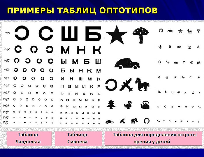 Примеры таблиц оптотипов