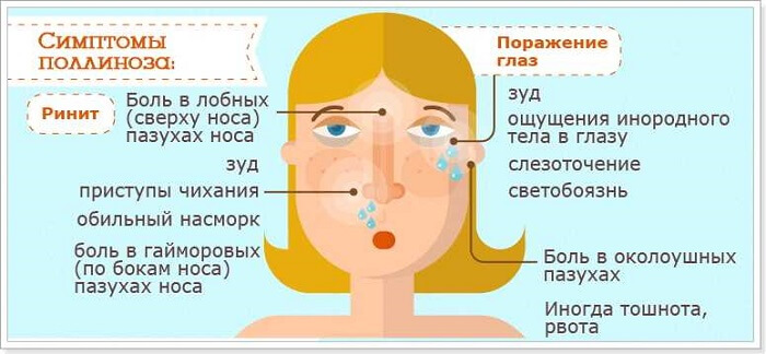 Признаки поллиноза