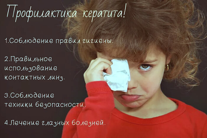 Профилактика глазного кератита
