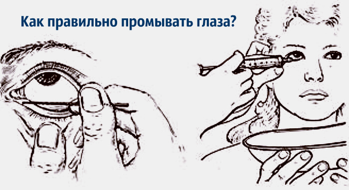 Процедура промывания глаз