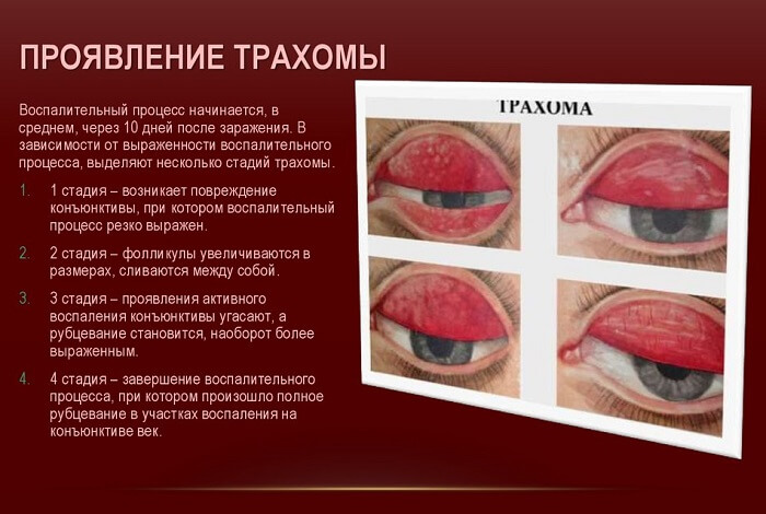 Проявление данного заболевания
