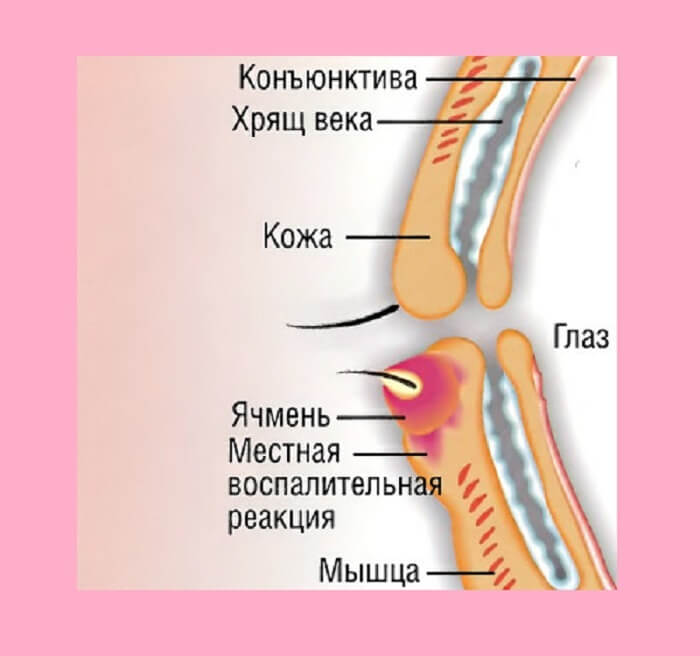 Расположение данного недуга