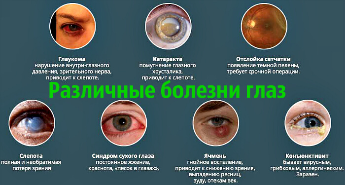 Разновидности болезней