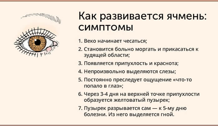 Симптомы развития ячменя