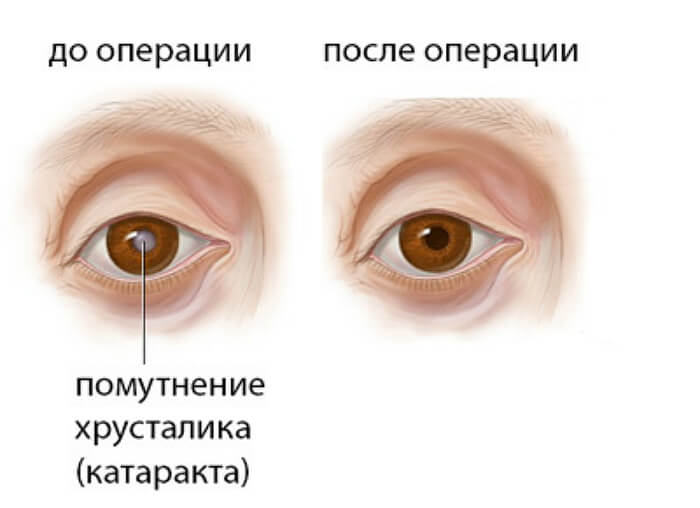 Результат операции