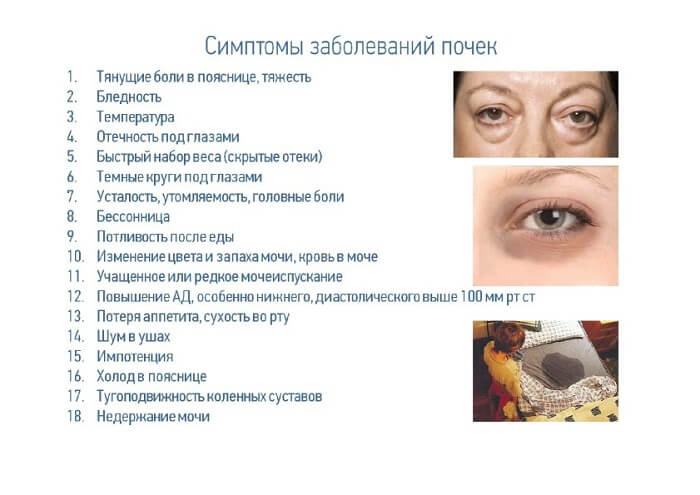 Симптомы болезни почек