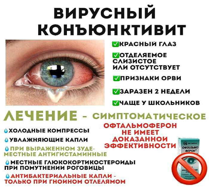 Симптомы вирусного конъюктивита