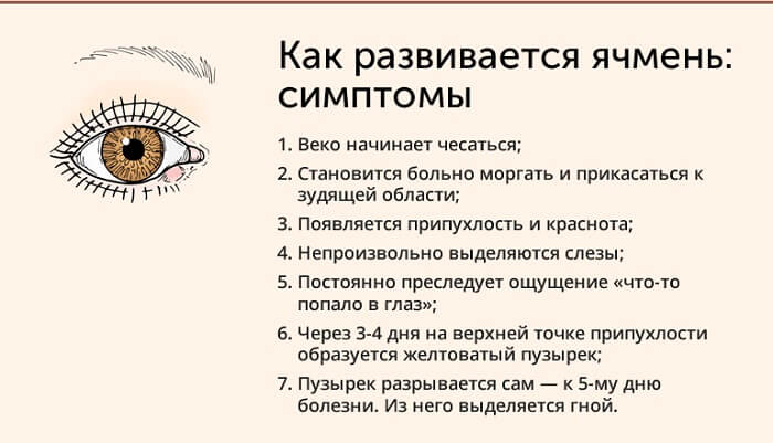 Симптомы ячменя человека
