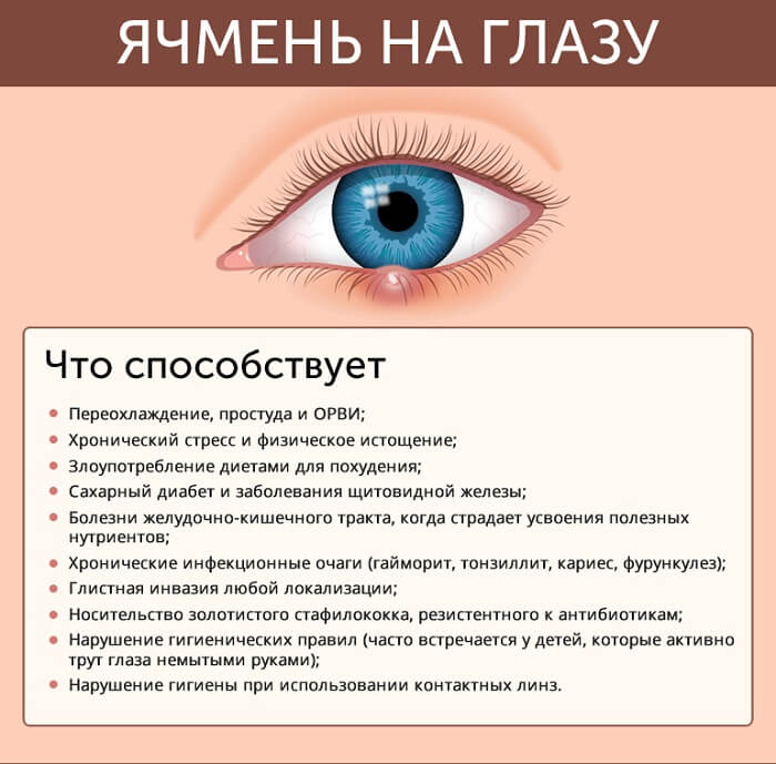 Что способствует появлению