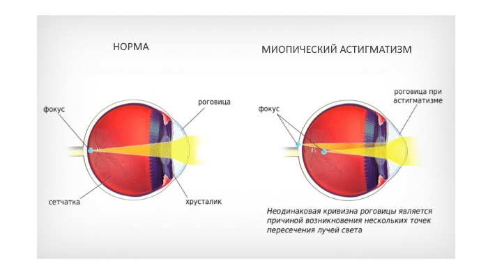 Сравнение глаз