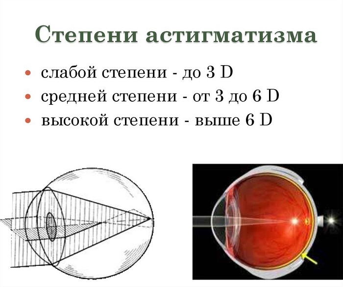 Степени патологии